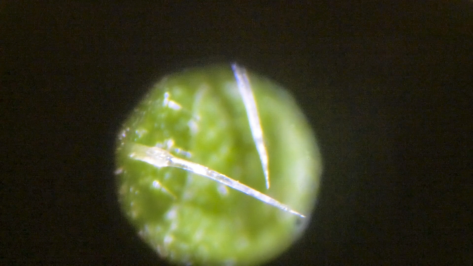 Eine mikroskopische Aufnahme von der Brennnessel